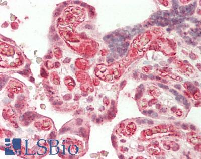 LARP7 Antibody - Human Placenta: Formalin-Fixed, Paraffin-Embedded (FFPE)