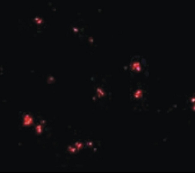 LASS5 Antibody - Immunofluorescence of LASS5 in human brain tissue with LASS5 antibody at 20 ug/ml.