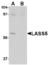LASS5 Antibody - Western blot of LASS5 in SK-N-SH lysate with LASS5 antibody at 1 ug/ml in the (A) absence and (B) presence of blocking peptide.