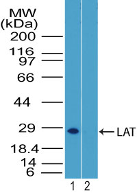 LAT Antibody - Western blot of LAT in mouse thymus tissue lysate in the 1) absence and 2) presence of immunizing peptide using LAT Antibody at 2 ug/ml. Goat anti-rabbit Ig HRP secondary antibody, and PicoTect ECL substrate solution were used for this test.