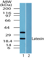 Latexin / MUM Antibody - Western blot of Latexin in human pancreas lysate in the 1) absence and 2) presence of immunizing peptide using Latexin / MUM Antibody at 0.01 ug/ml.