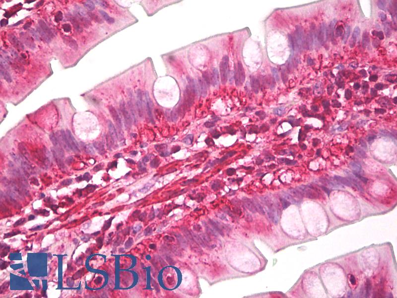 Latexin / MUM Antibody - Anti-Latexin / MUM antibody IHC of human small intestine. Immunohistochemistry of formalin-fixed, paraffin-embedded tissue after heat-induced antigen retrieval. Antibody dilution 5 ug/ml.