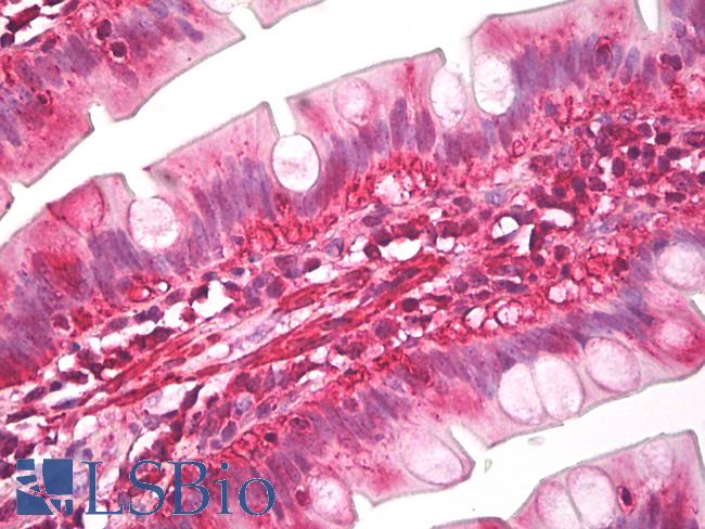 Latexin / MUM Antibody - Anti-Latexin / MUM antibody IHC of human small intestine. Immunohistochemistry of formalin-fixed, paraffin-embedded tissue after heat-induced antigen retrieval. Antibody dilution 5 ug/ml.