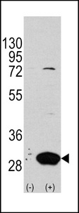 Latexin / MUM Antibody - Western blot of Latexin (arrow) using rabbit polyclonal Latexin Antibody (RB12661). 293 cell lysates (2 ug/lane) either nontransfected (Lane 1) or transiently transfected with the LXN gene (Lane 2) (Origene Technologies).