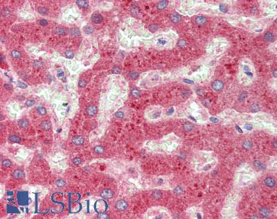 LBP Antibody - Human Liver: Formalin-Fixed, Paraffin-Embedded (FFPE), at a dilution of 1:100.