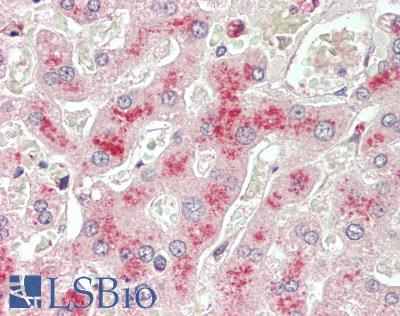 LCAT Antibody - Human Liver: Formalin-Fixed, Paraffin-Embedded (FFPE), at a concentration of 5 ug/ml. 
