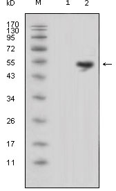 LCN1 / Lipocalin-1 Antibody - Western blot using LCN1 mouse monoclonal antibody against HEK293 (1) and LCN1-hIgGFc transfected HEK293 cell lysate (2).