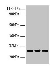 LCN2 / Lipocalin 2 / NGAL Antibody - Western blot All lanes: NGAL antibody at 2µg/ml + positive serum Lane 1: positive serum at 1: 10 Lane 2: positive serum at 1: 100 Lane 3: positive serum at 1: 500 Secondary Goat polyclonal to rabbit IgG at 1/15000 dilution Predicted band size: 22 kDa Observed band size: 25 kDa