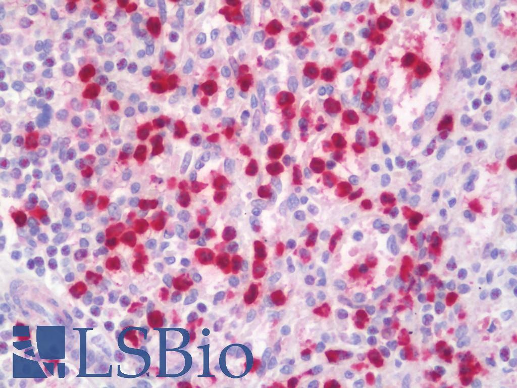 LCN2 / Lipocalin 2 / NGAL Antibody - Anti-LCN2 / Lipocalin 2 / NGAL antibody IHC staining of human spleen. Immunohistochemistry of formalin-fixed, paraffin-embedded tissue after heat-induced antigen retrieval. Antibody concentration 5 ug/ml.  This image was taken for the unconjugated form of this product. Other forms have not been tested.