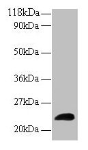 LCN2 / Lipocalin 2 / NGAL Antibody - Western blot All lanes: NGAL antibody at 2µg/ml + positive serum Lane 1: positive serum at 1: 10 Lane 2: positive serum at 1: 50 Secondary Goat polyclonal to rabbit IgG at 1/15000 dilution Predicted band size: 22 kDa Observed band size: 22 kDa