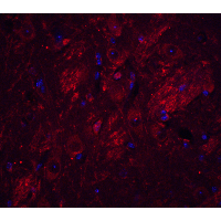 LCX / TET1 Antibody - Immunofluorescence of TET1 in mouse brain tissue with TET1 antibody at 20 µg/mL.