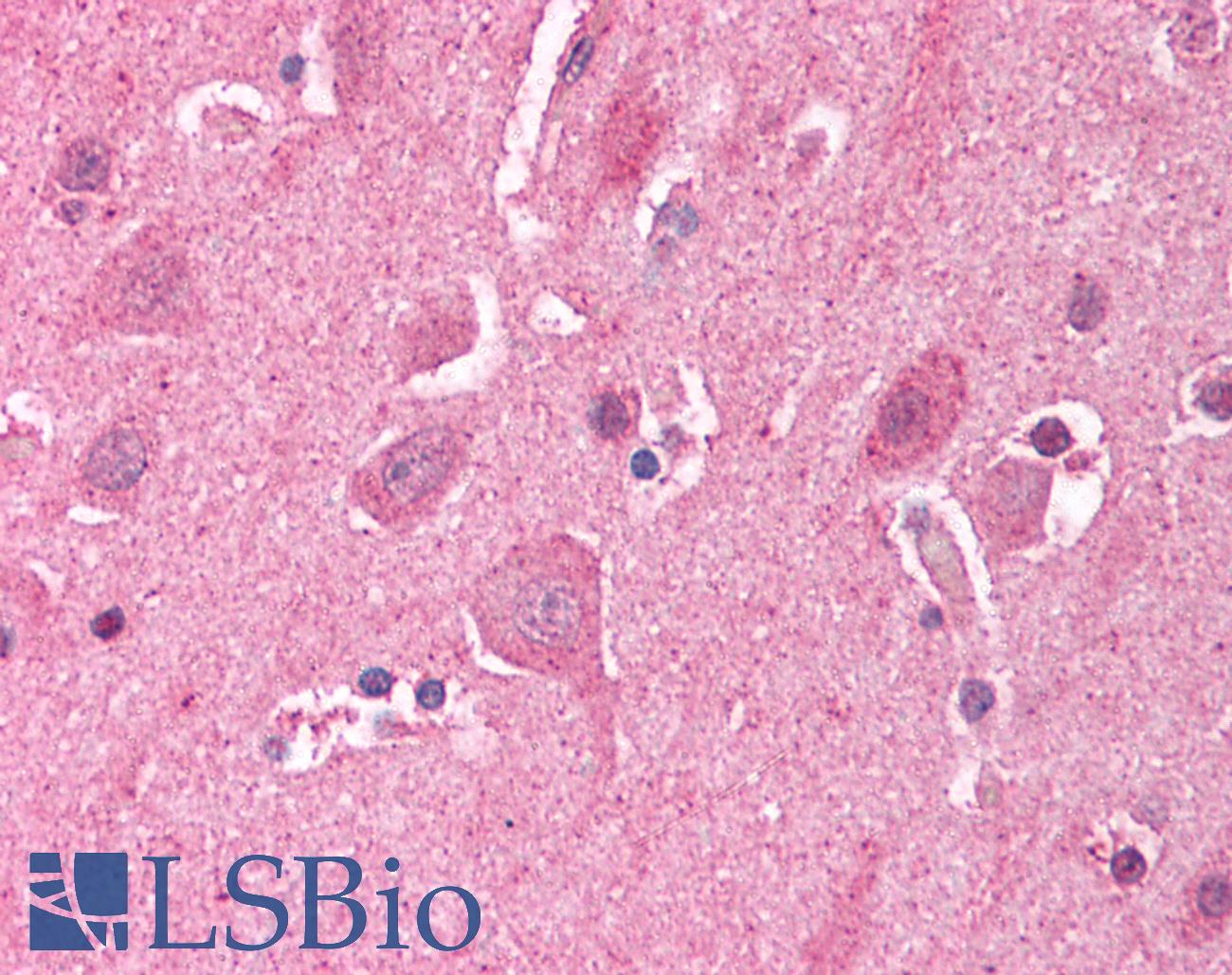 LDB2 Antibody - Anti-LDB2 antibody IHC of human brain, cortex. Immunohistochemistry of formalin-fixed, paraffin-embedded tissue after heat-induced antigen retrieval. Antibody concentration 5 ug/ml.
