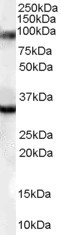 LDB3 / ZASP Antibody - Antibody (0.01 ug/ml) staining of human muscle lysate (35 ug protein in RIPA buffer). Primary incubation was 1 hour. Detected by chemiluminescence.