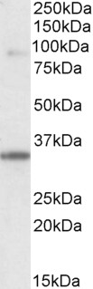 LDB3 / ZASP Antibody - Goat Anti-ZASP/ CYPHER / LDB3 Antibody (0.1µg/ml) staining of Human Skeletal Muscle lysate (35µg protein in RIPA buffer). Primary incubation was 1 hour. Detected by chemiluminescencence.