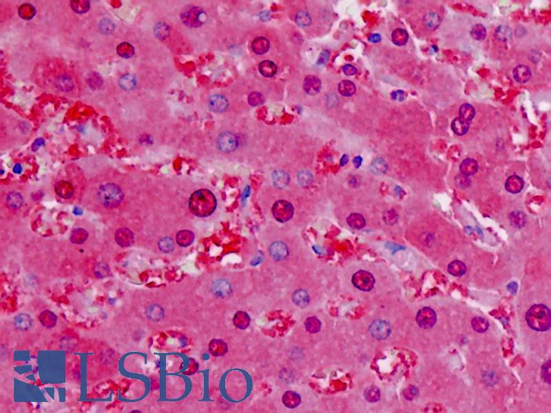 LDH / Lactate Dehydrogenase Antibody - Anti-LDH / Lactate Dehydrogenase antibody IHC staining of human liver. Immunohistochemistry of formalin-fixed, paraffin-embedded tissue after heat-induced antigen retrieval.