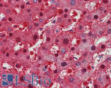 LDHA / LDH1 Antibody - Human Liver: Formalin-Fixed, Paraffin-Embedded (FFPE)
