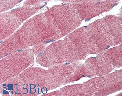LDHA / LDH1 Antibody - Human Skeletal Muscle: Formalin-Fixed, Paraffin-Embedded (FFPE)