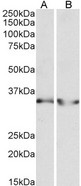 LDHB / Lactate Dehydrogenase B Antibody - LDHB antibody (0.3 ug/ml) staining of Human Heart (A) and Human Kidney (B) lysates (35 ug protein in RIPA buffer). Primary incubation was 1 hour. Detected by chemiluminescence.