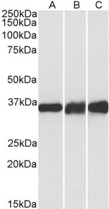 LDHB / Lactate Dehydrogenase B Antibody - LDHB antibody (0.1 ug/ml) staining of Human (A), Mouse (B) and Rat (C) Heart lysates (35 ug protein in RIPA buffer). Primary incubation was 1 hour. Detected by chemiluminescence.