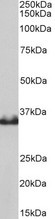 LDHB / Lactate Dehydrogenase B Antibody - Goat Anti-LDHB Antibody (0.1µg/ml) staining of Pig Heart lysates (35µg protein in RIPA buffer). Primary incubation was 1 hour. Detected by chemiluminescencence.