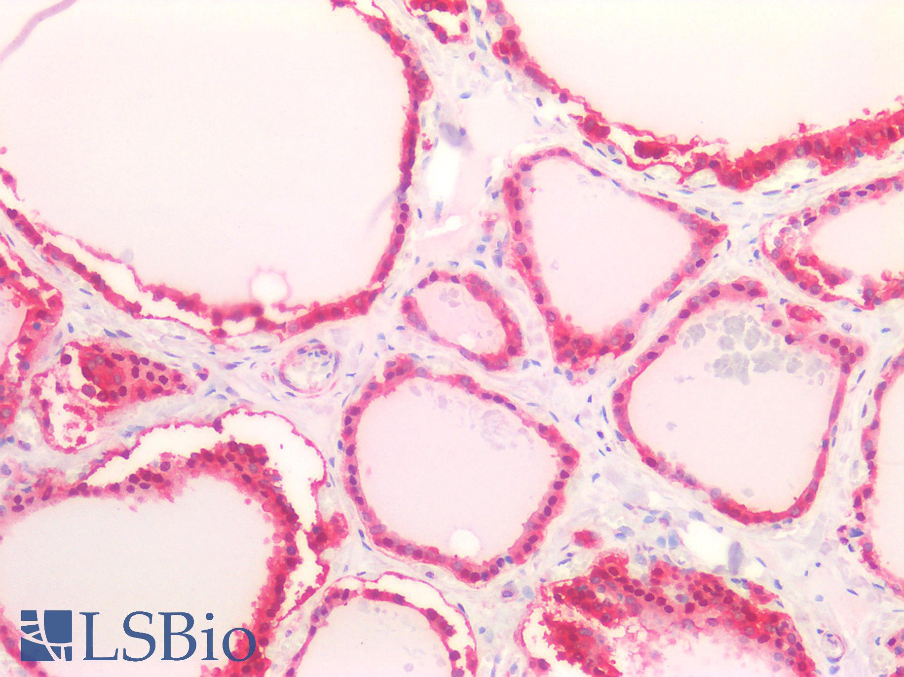 LDHB / Lactate Dehydrogenase B Antibody - Human Thyroid: Formalin-Fixed, Paraffin-Embedded (FFPE)