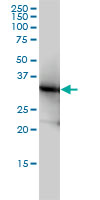 LDHB / Lactate Dehydrogenase B Antibody - LDHB monoclonal antibody clone 2H6 Western blot of LDHB expression in HeLa.