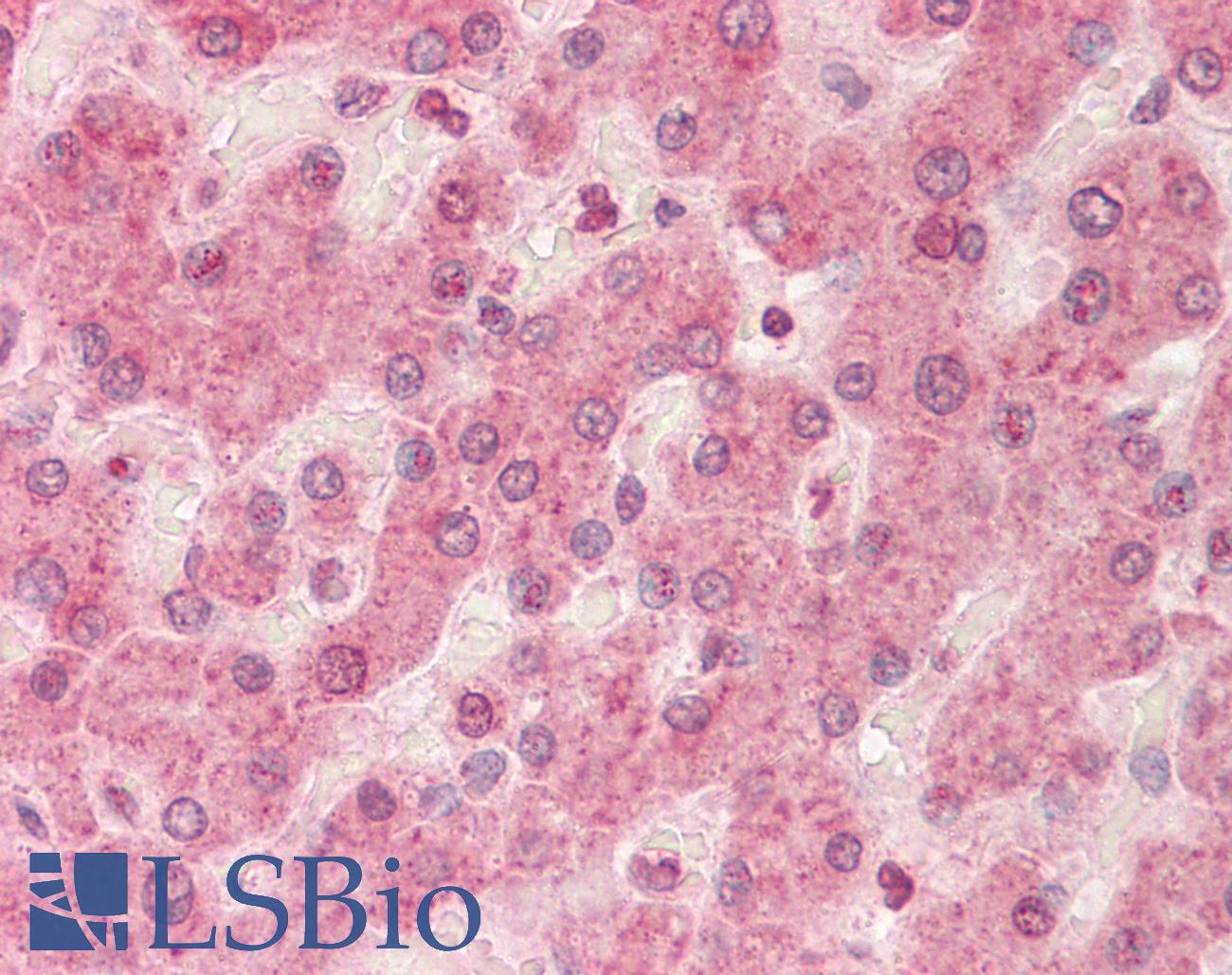 LDLR / LDL Receptor Antibody - Anti-LDLR / LDL Receptor antibody IHC staining of human liver. Immunohistochemistry of formalin-fixed, paraffin-embedded tissue after heat-induced antigen retrieval. Antibody concentration 5 ug/ml.  This image was taken for the unconjugated form of this product. Other forms have not been tested.