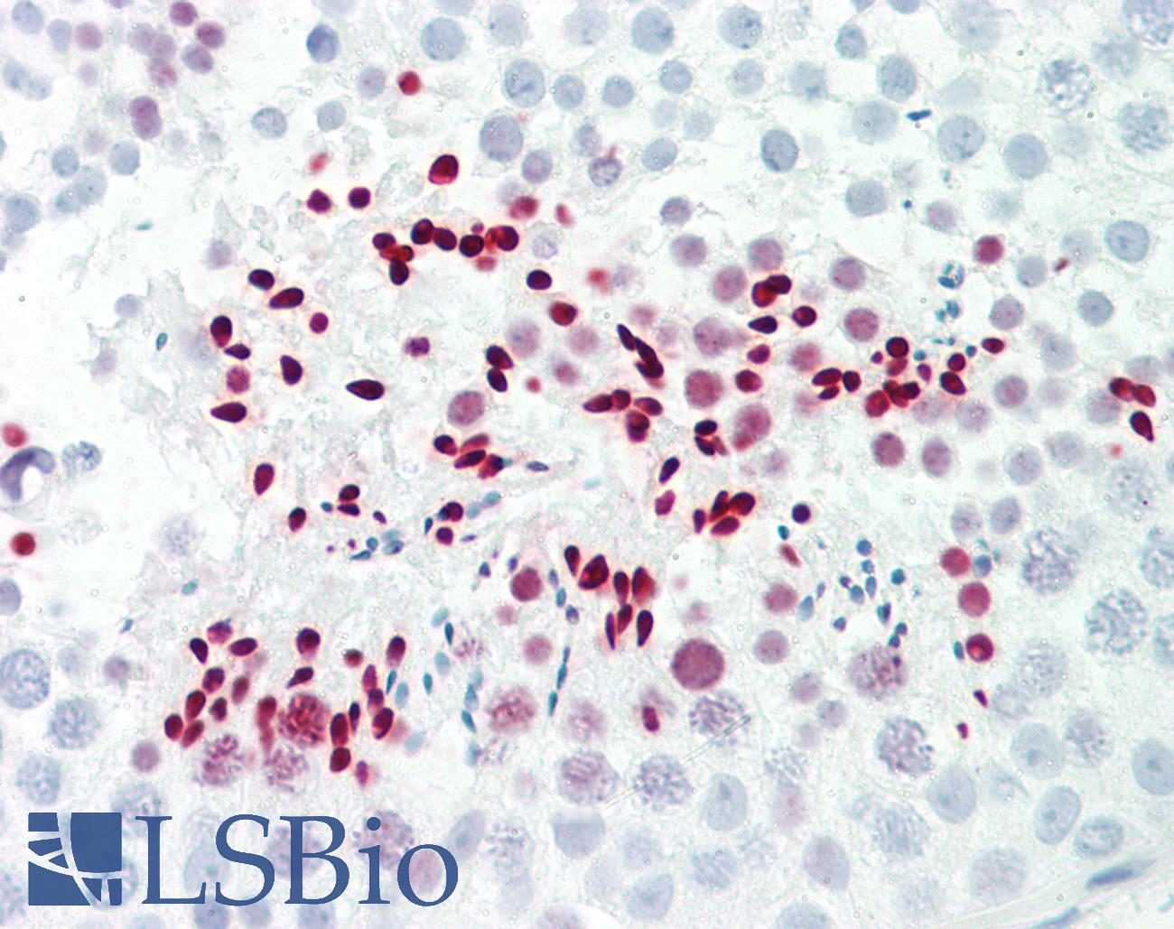 LDOC1L Antibody - Anti-LDOC1L antibody IHC staining of human testis. Immunohistochemistry of formalin-fixed, paraffin-embedded tissue after heat-induced antigen retrieval. Antibody dilution 1:100.