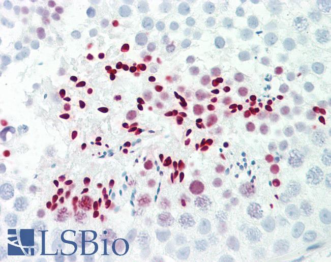 LDOC1L Antibody - Anti-LDOC1L antibody IHC staining of human testis. Immunohistochemistry of formalin-fixed, paraffin-embedded tissue after heat-induced antigen retrieval. Antibody dilution 1:100.