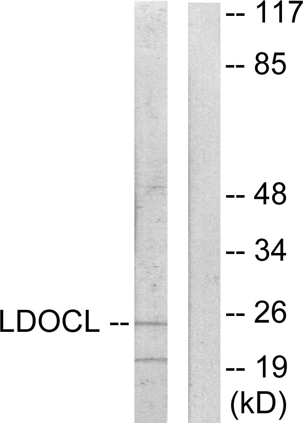 LDOC1L Antibody - Western blot analysis of lysates from COLO205 cells, using LDOC1L Antibody. The lane on the right is blocked with the synthesized peptide.