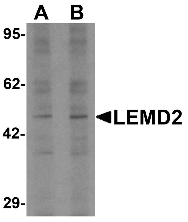 LEMD2 Antibody - Western blot analysis of LEMD2 in 293 cell lysate with LEMD2 antibody at (A) 1 and (B) 2 ug/ml.