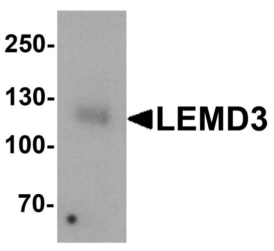 LEMD3 / MAN1 Antibody - Western blot analysis of LEMD3 in human colon tissue lysate with LEMD3 antibody at 1 ug/ml.