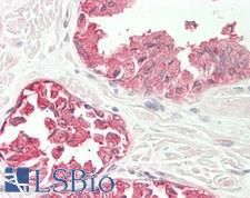 LENG8 Antibody - Human Prostate: Formalin-Fixed, Paraffin-Embedded (FFPE)