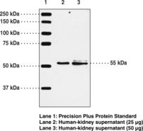 Leukotriene B4 Receptor / BLT1 Antibody - Western blot of Leukotriene B4 Receptor / BLT1 antibody.