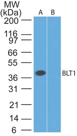 Leukotriene B4 Receptor / BLT1 Antibody - Western blot of BLT1 antibody. Lysate from human muscle in the 1) absence, 2) presence of immunizing peptide probed with BLT1 antibody at 3 ug/ml.