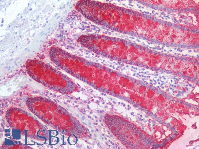 Lewis y / BG8 / CD174 Antibody - Human Colon: Formalin-Fixed, Paraffin-Embedded (FFPE)