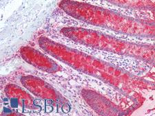 Lewis y / BG8 / CD174 Antibody - Human Colon: Formalin-Fixed, Paraffin-Embedded (FFPE)