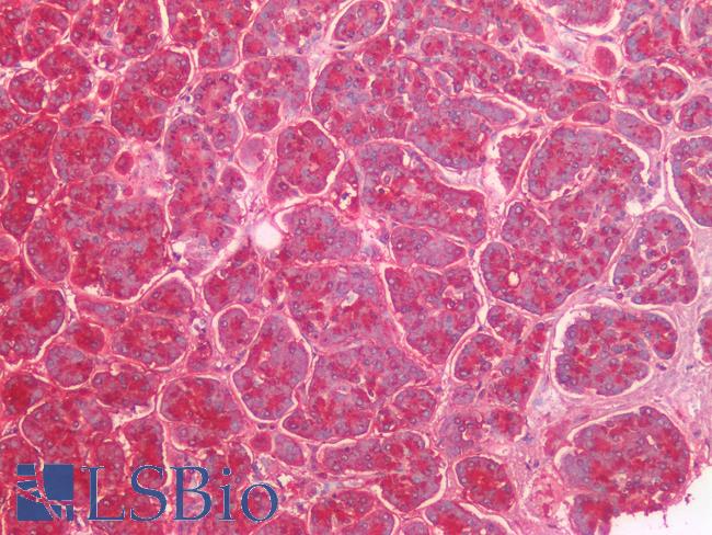 Lewis y / BG8 / CD174 Antibody - Human Pancreas: Formalin-Fixed, Paraffin-Embedded (FFPE)