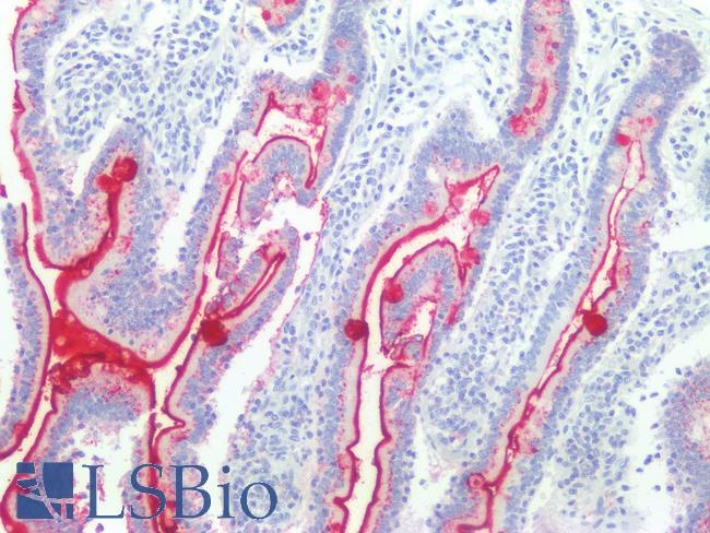 Lewis y / BG8 / CD174 Antibody - Human Small Intestine: Formalin-Fixed, Paraffin-Embedded (FFPE)