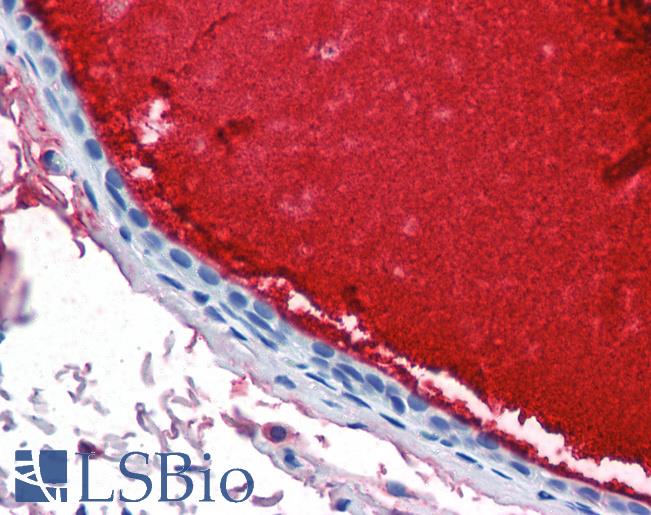 LF / LTF / Lactoferrin Antibody - Anti-LTF / Lactoferrin antibody IHC of human breast, ductal with secretion. Immunohistochemistry of formalin-fixed, paraffin-embedded tissue after heat-induced antigen retrieval. Antibody concentration 10 ug/ml.