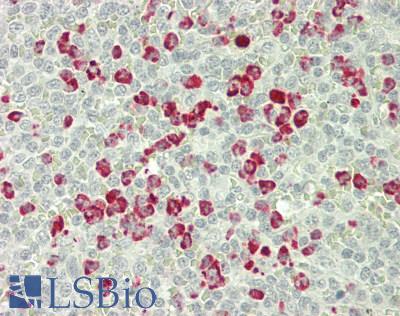 LF / LTF / Lactoferrin Antibody - Human Spleen: Formalin-Fixed, Paraffin-Embedded (FFPE)