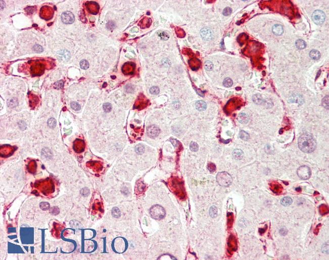 LFNG / Lunatic Fringe Antibody - Anti-LFNG / Lunatic Fringe antibody IHC staining of human liver. Immunohistochemistry of formalin-fixed, paraffin-embedded tissue after heat-induced antigen retrieval.