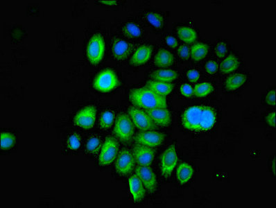 LGALS1 / Galectin 1 Antibody - Immunofluorescent analysis of A549 cells using LGALS1 Antibody at dilution of 1:100 and Alexa Fluor 488-congugated AffiniPure Goat Anti-Rabbit IgG(H+L)