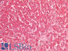 LGALS1 / Galectin 1 Antibody - Human Liver: Formalin-Fixed, Paraffin-Embedded (FFPE)