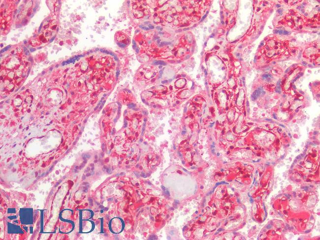 LGALS1 / Galectin 1 Antibody - Human Placenta: Formalin-Fixed, Paraffin-Embedded (FFPE)