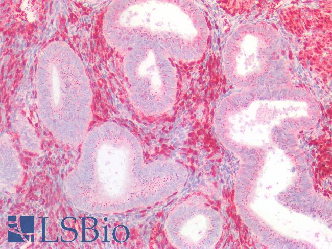 LGALS1 / Galectin 1 Antibody - Human Uterus: Formalin-Fixed, Paraffin-Embedded (FFPE)