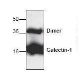 LGALS1 / Galectin 1 Antibody - Western blot of Galectin 1 antibody.