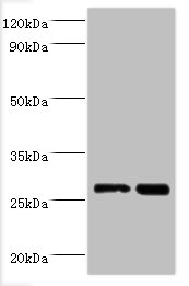 LGALS3 / Galectin 3 Antibody - All lanes: Galectin-3 antibody at 2ug/ml Lane 1:Hela whole cell lysate Lane 2:MCF-7 whole cell lysate Secondary Goat polyclonal to rabbit at 1/10000 dilution Predicted band size: 26kDa Observed band size: 26kDa