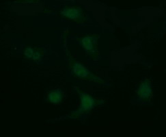LGALS3 / Galectin 3 Antibody - Immunofluorescent staining of HeLa cells using anti-LGALS3 mouse monoclonal antibody.