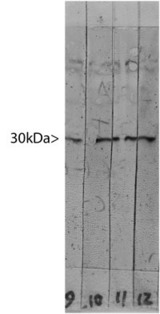 LGALS3 / Galectin 3 Antibody - Blots of crude HeLa cell extract stained with a panel of monoclonal antibodies to Galectin-3. Lane 12 was probed with LGALS3 / Galectin 3 Antibody, revealing a band at the expected molecular weight of 30kDa.